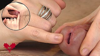 Tender Sounding - Super Close-up of Urethral Penetration