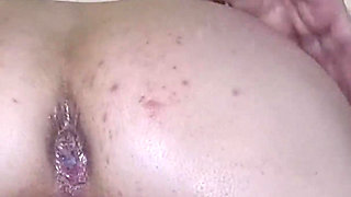 Wife First Anal. Anal Creampie. Enema. 24201