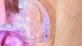 Super Cute Redhead Kaira Love Gets Her Cervix Examined with Speculum