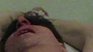 Massive Treatment